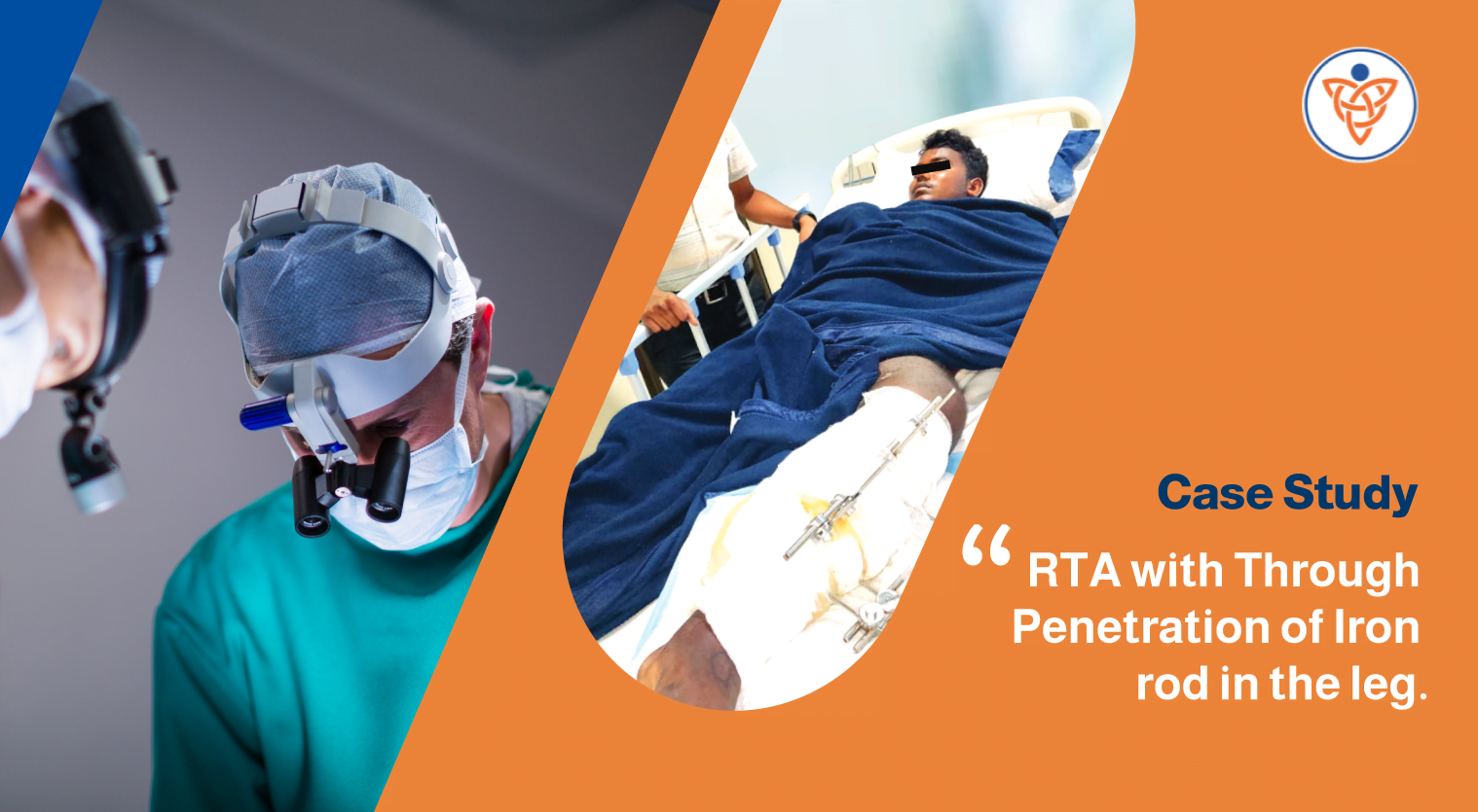 Case study - RTA with Through and Through Penetration of Iron rod in the leg | VishwaRaj Hospital