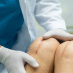 Knee Replacement Surgery - VishwaRaj Hospital
