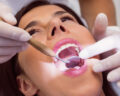 Oral Surgery - VishwaRaj Hospital