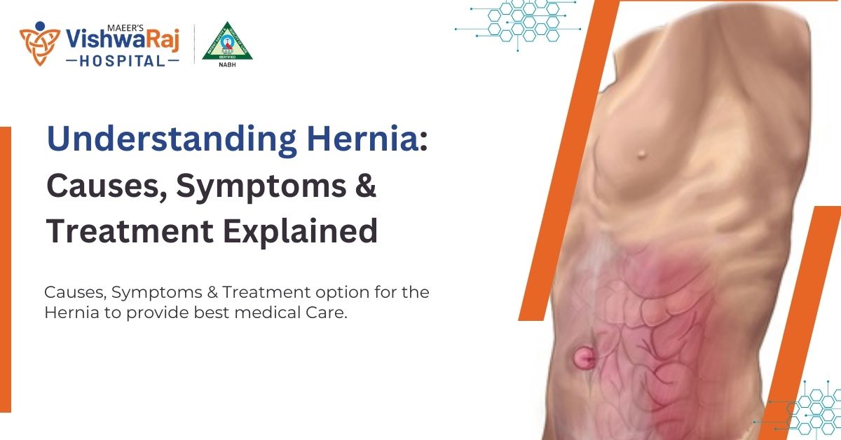 Understanding Hernia - Causes, Symptoms, and the Best Treatment Options for Optimal Medical Care