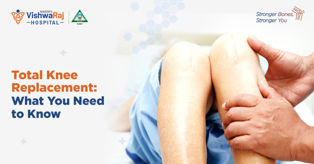 Total Knee Replacement