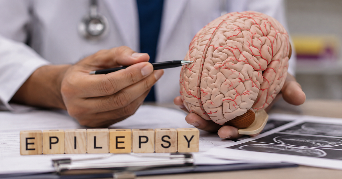 Epilepsy