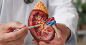 Kidney Transplantj