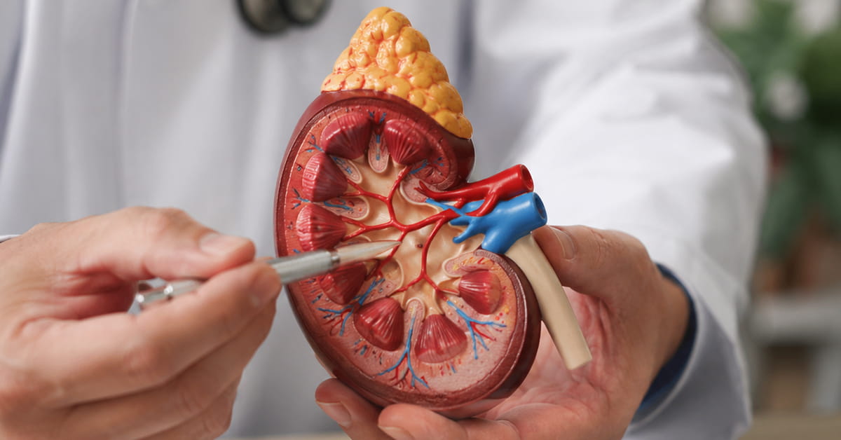 Kidney Transplantj