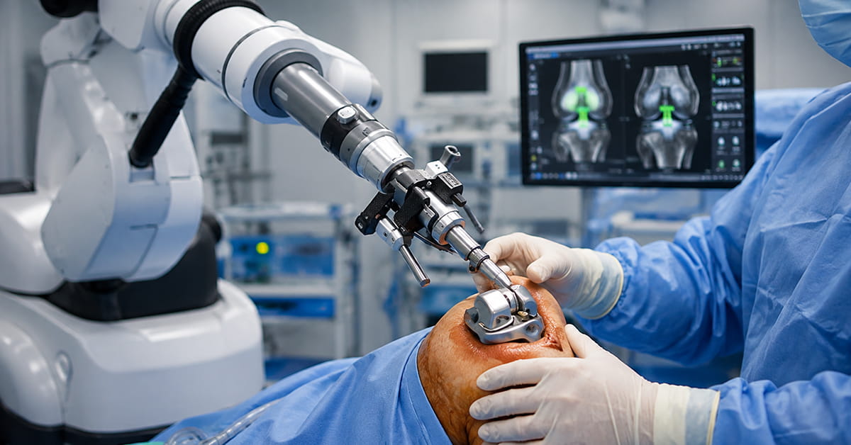 Robotic Knee Replacement