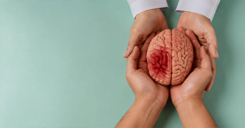Stroke Treatment in Pune