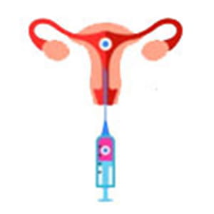 Embryo Transfer
