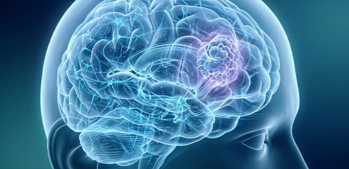 VRH Brain Cancer Inner