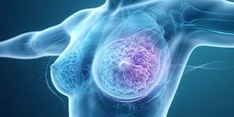 VRH Breast Cancer Outer