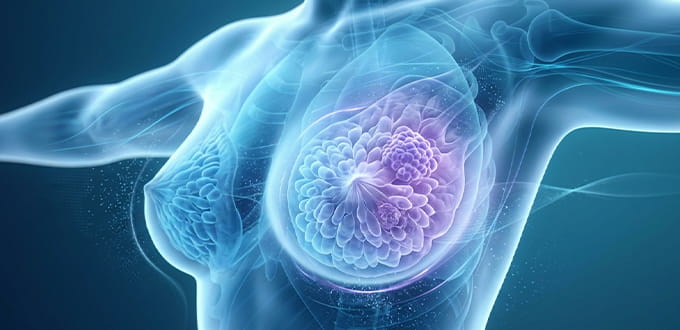 VRH Breast Cancer Inner