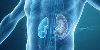 VRH Chronic Kidney Disease Outer