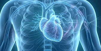 VRH Coronary Artery Disease_Outer