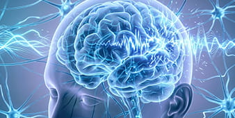 VRH Epilepsy Outer