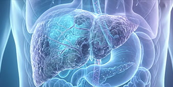 VRH Liver Cirrhosis Outer