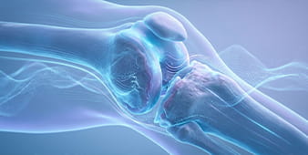 VRH Osteoarthritis Outer
