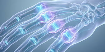 VRH Rheumatoid Arthritis Outer