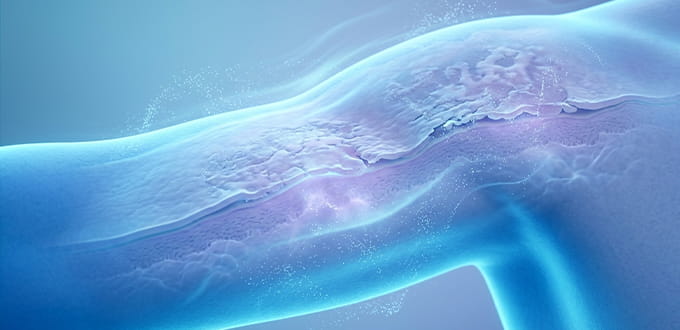VRH Skin Diseases Inner