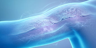 VRH Skin Diseases Outer