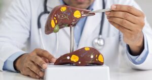 Fatty Liver - Vishwaraj Hospital - Vishwaraj Hospital Fatty Liver